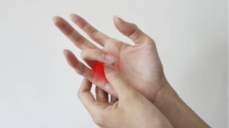 What is Trigger Finger? Causes, Symptoms and Treatment